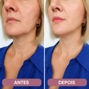 Cinta Modeladora Facial com Efeito Lifting
