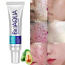 Creme Secativo Removedor Acne Espinha Manchas Bioaqua | 30g